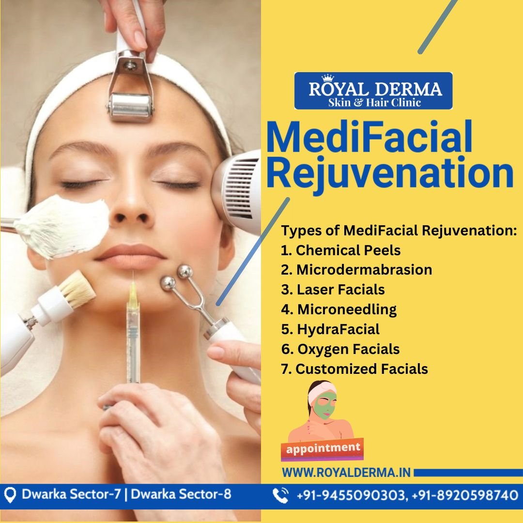 Best Medi Facial Treatment in Dwarka, Delhi