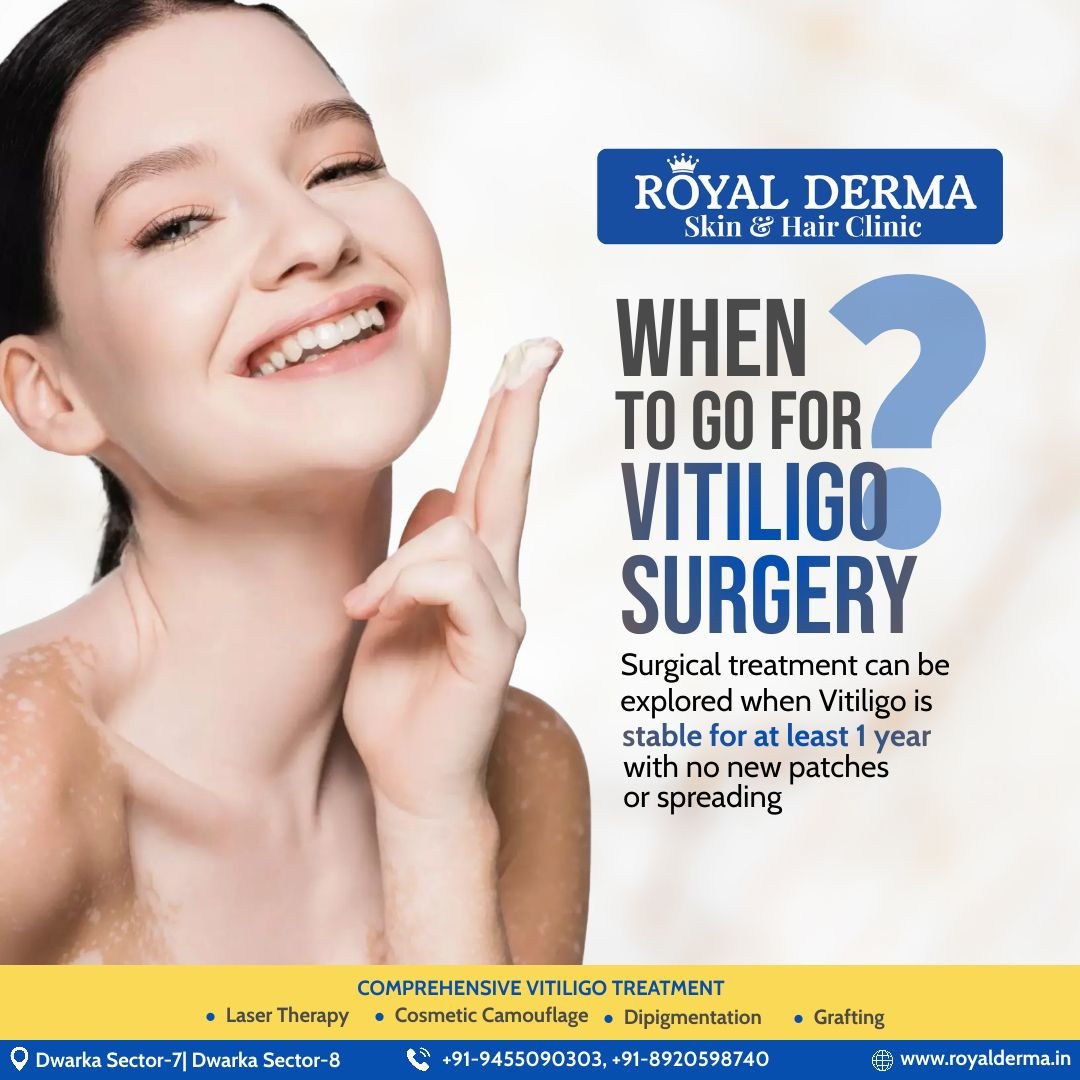 Vitiligo Treatment and Clinic in Dwarka, Delhi.