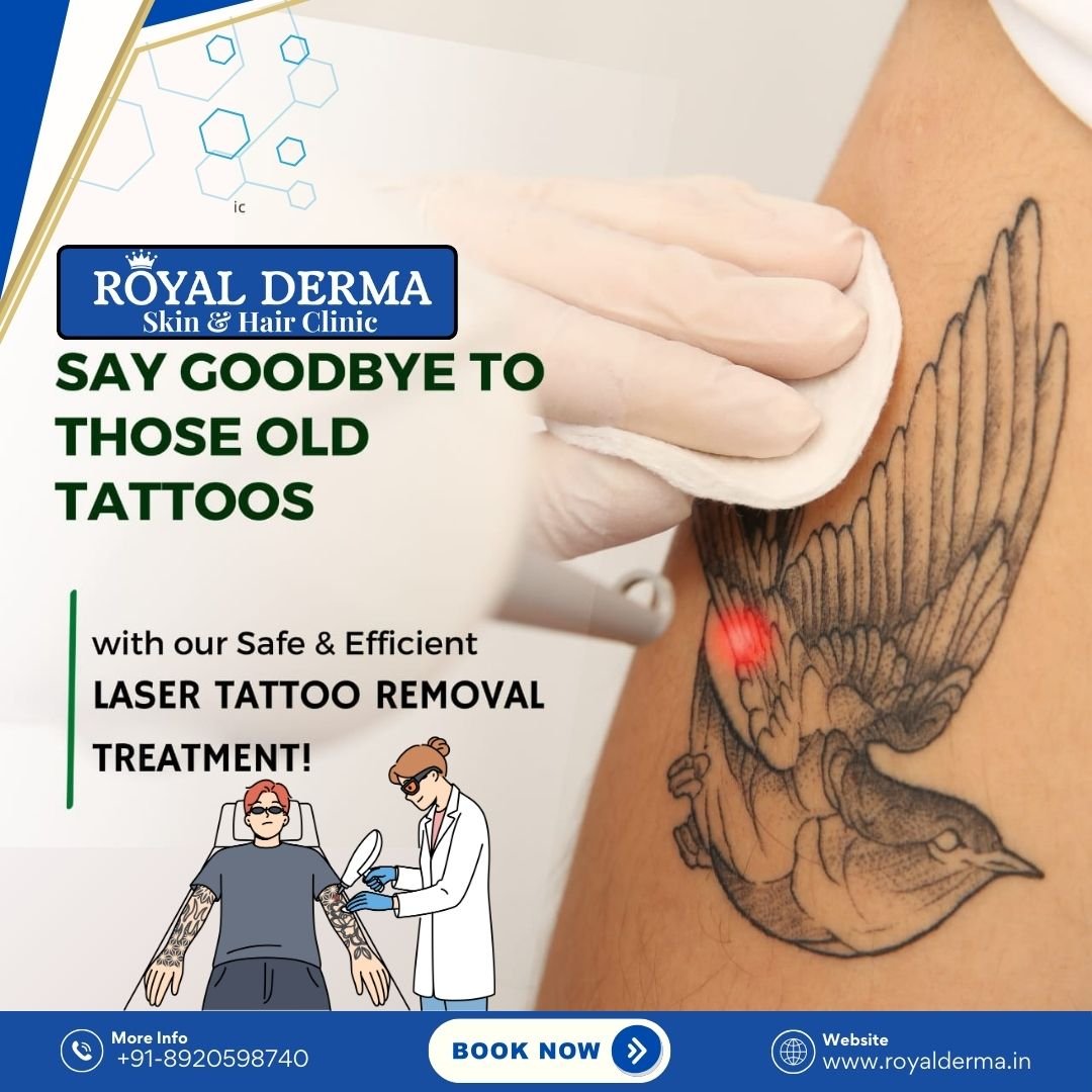 Best Clinic for Tattoo Removal Treatment in Dwarka, Delhi.