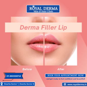 Best clinic for dermal filler lip treatment