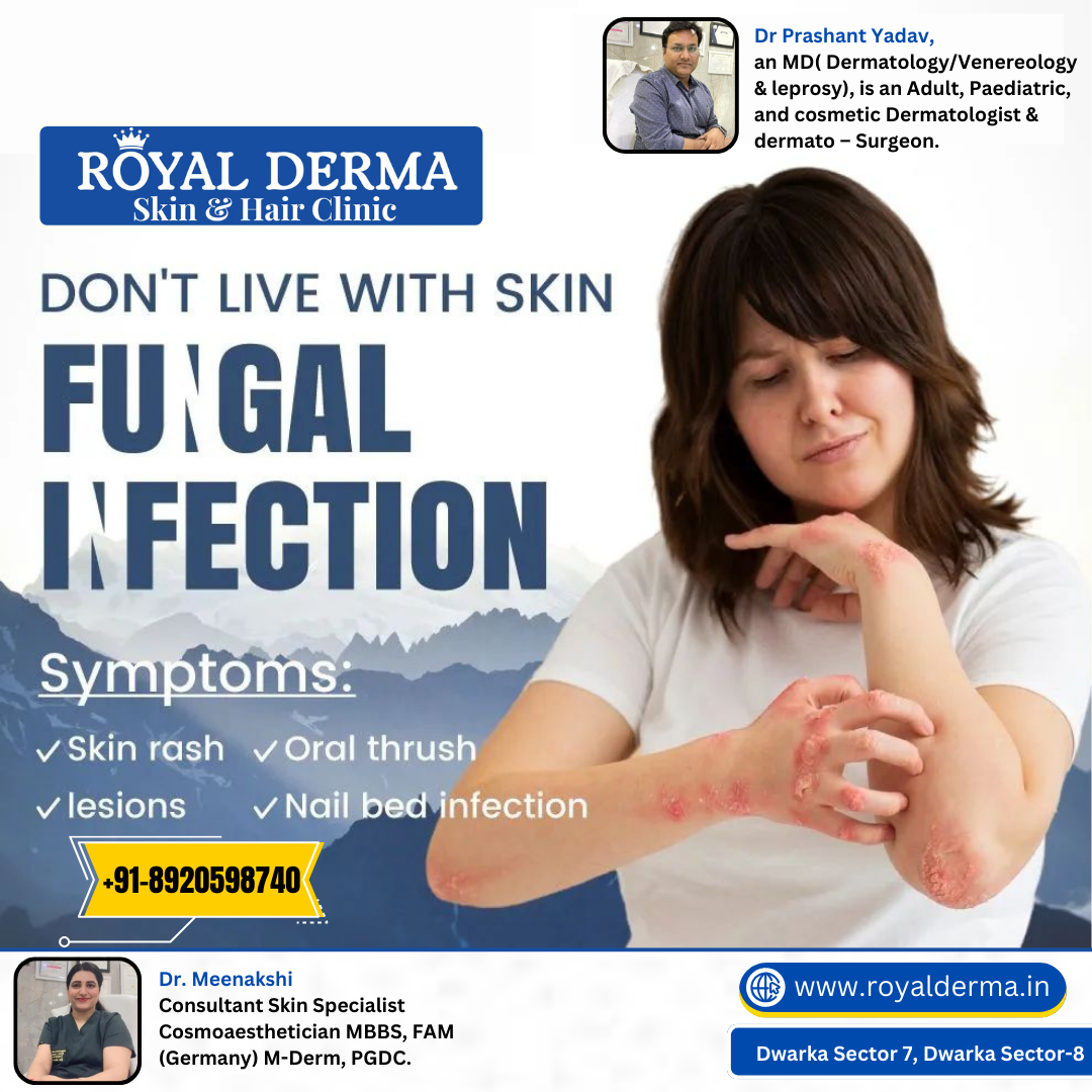 Best treatment for fungal infection