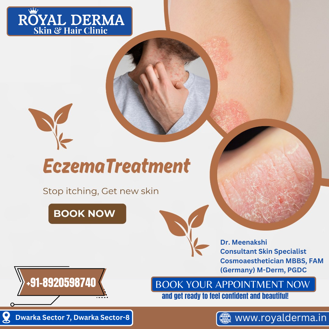 Eczema specialist doctor in Dwarka, Delhi.