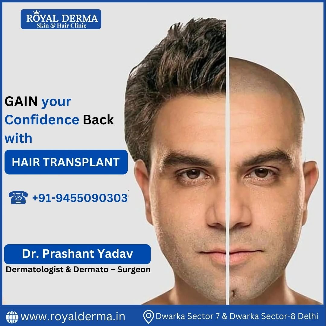 GAIN your Confidence BACK with HAIR TRANSPLANT