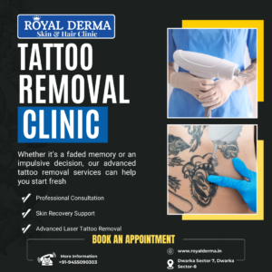 Tattoo Removal Clinic