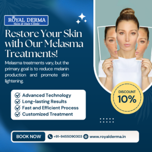 Restore Your Skin with Our Melasma Treatments!