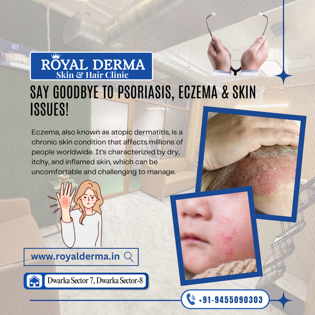 Say Goodbye to Psoriasis, Eczema & Skin Issues!