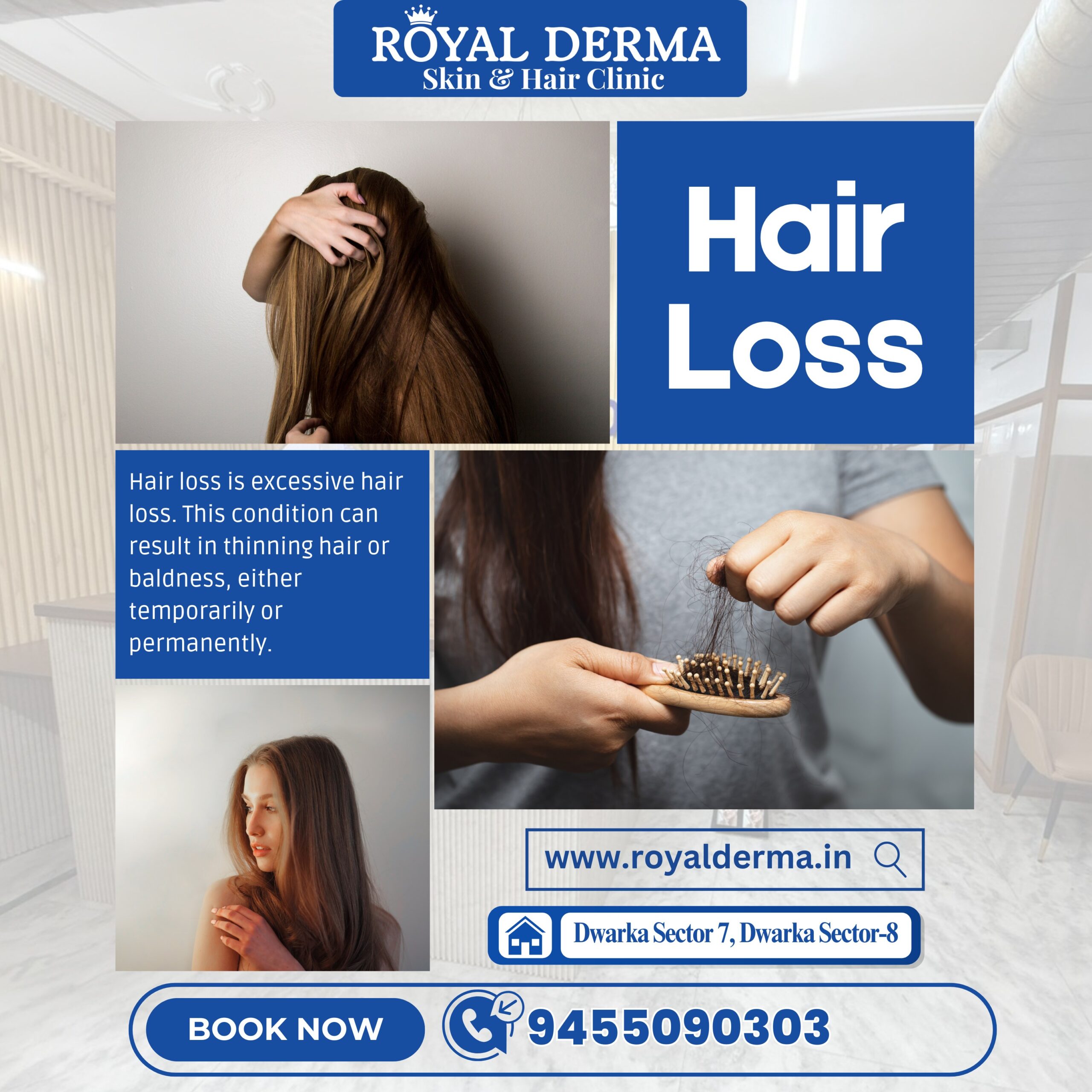 Hair loss treatment in Dwarka Delhi