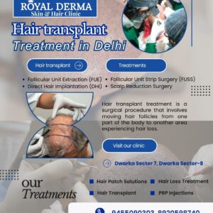 Hair Transplant Treatment in Delhi