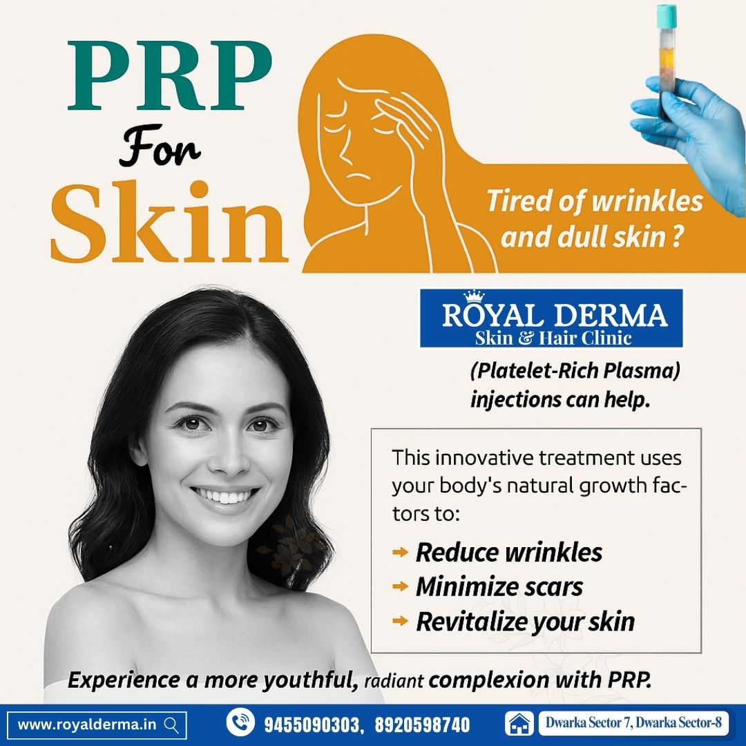 Best PRP Treatment for skin in Dwarka, Delhi.