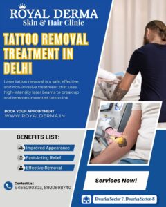 Tattoo removal treatment in Delhi