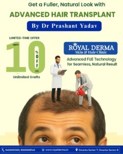 Advanced Hair Transplant in Dwarka, Delhi.