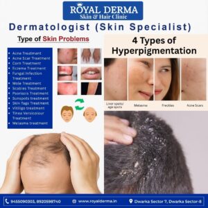 Best Skin Specialist in Delhi