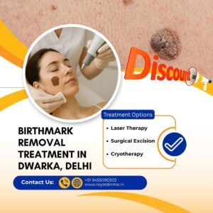 Birthmark Removal treatment in Dwarka, Delhi