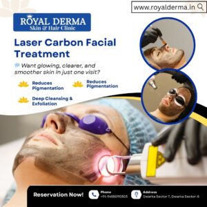 Laser Carbon Facial Treatment