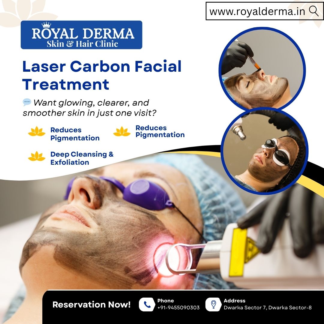 Laser Carbon Facial Treatment