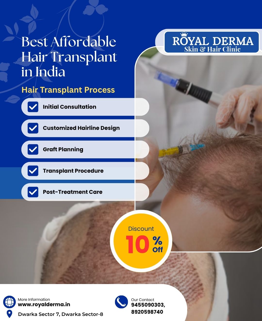 Best Affordable Hair Transplant in India