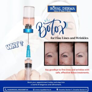 Botox for Fine Lines and Wrinkles