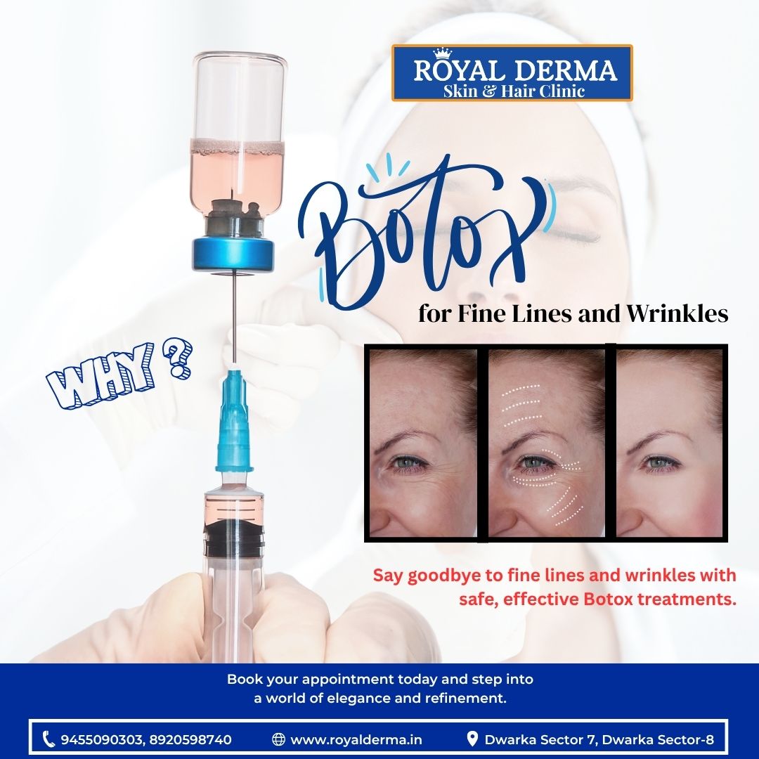 Botox for Fine Lines and Wrinkles