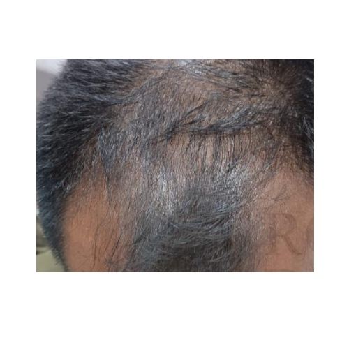Before Hair