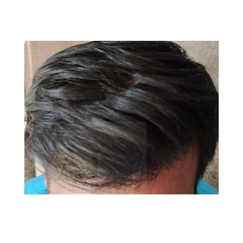 After Hair