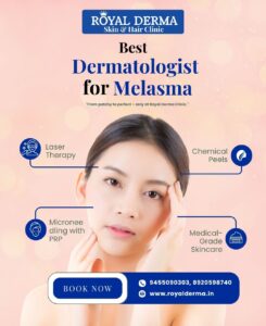 Best Dermatologist for Melasma in Dwarka, Delhi