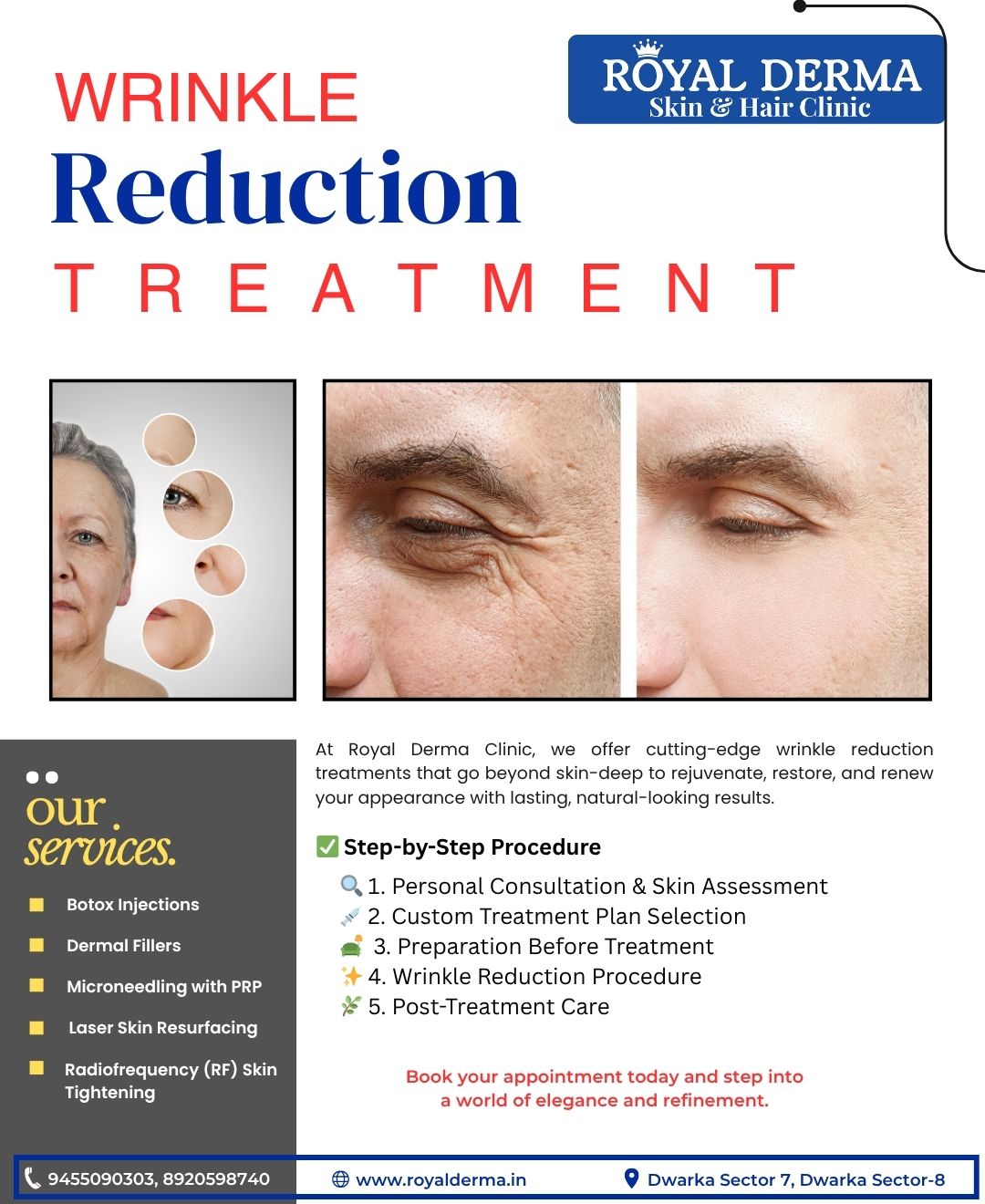 Wrinkle Reduction Treatment In Dwarka, Delhi