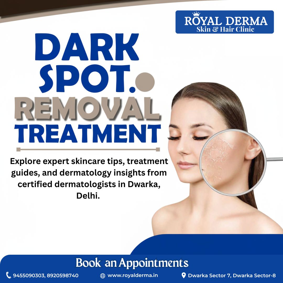 Dark spot treatment in Dwarka Delhi