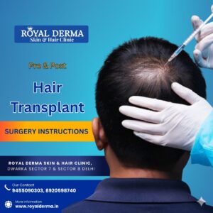 hair transplant pre and after