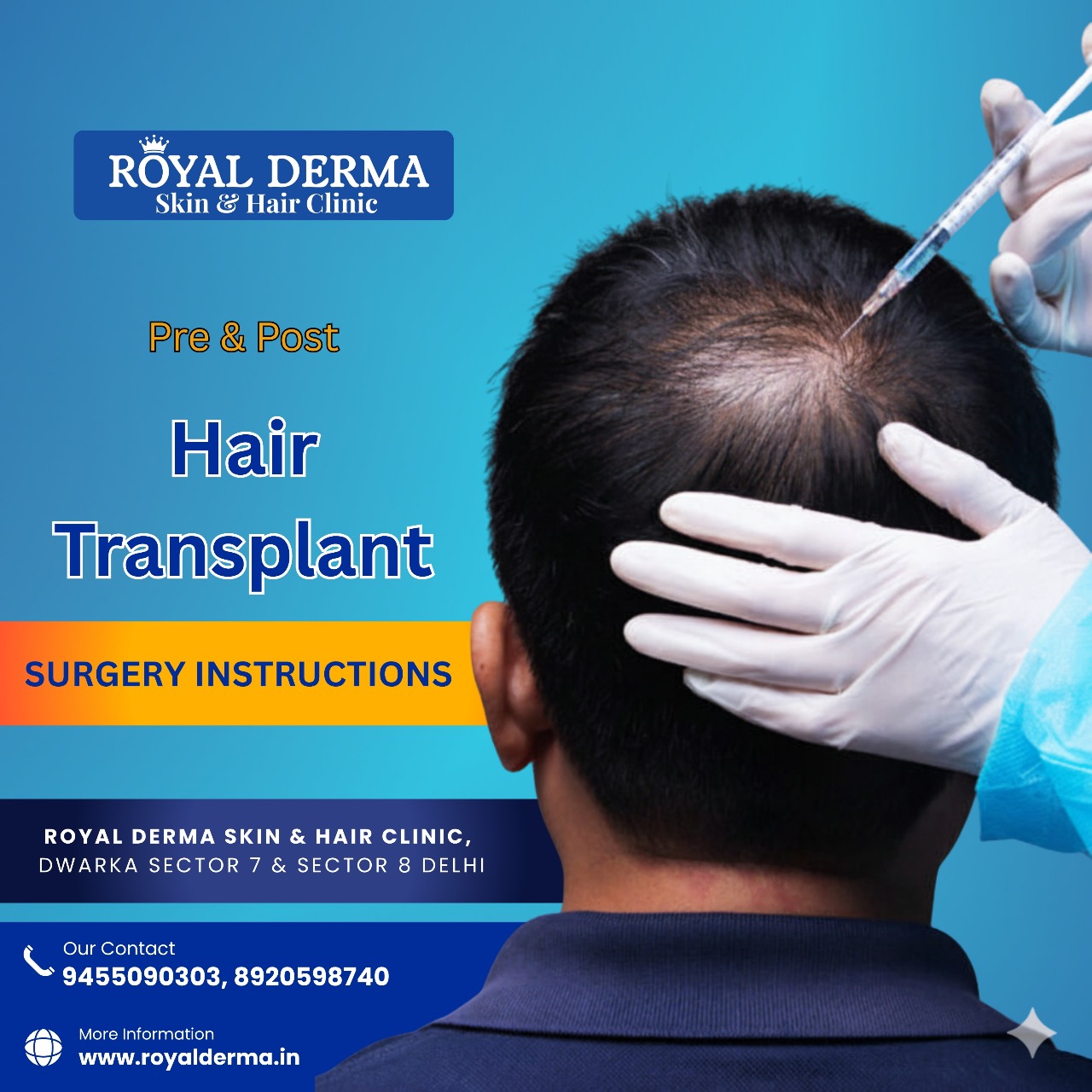 hair transplant pre and after