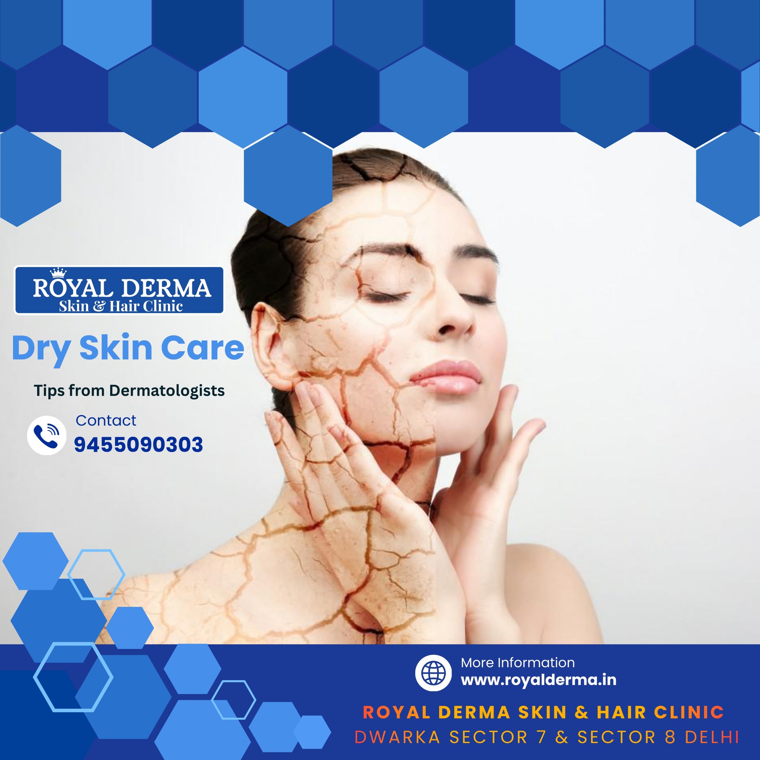 Dry Skin Care: Dermatologist-Approved Tips for Healthy, Hydrated Skin