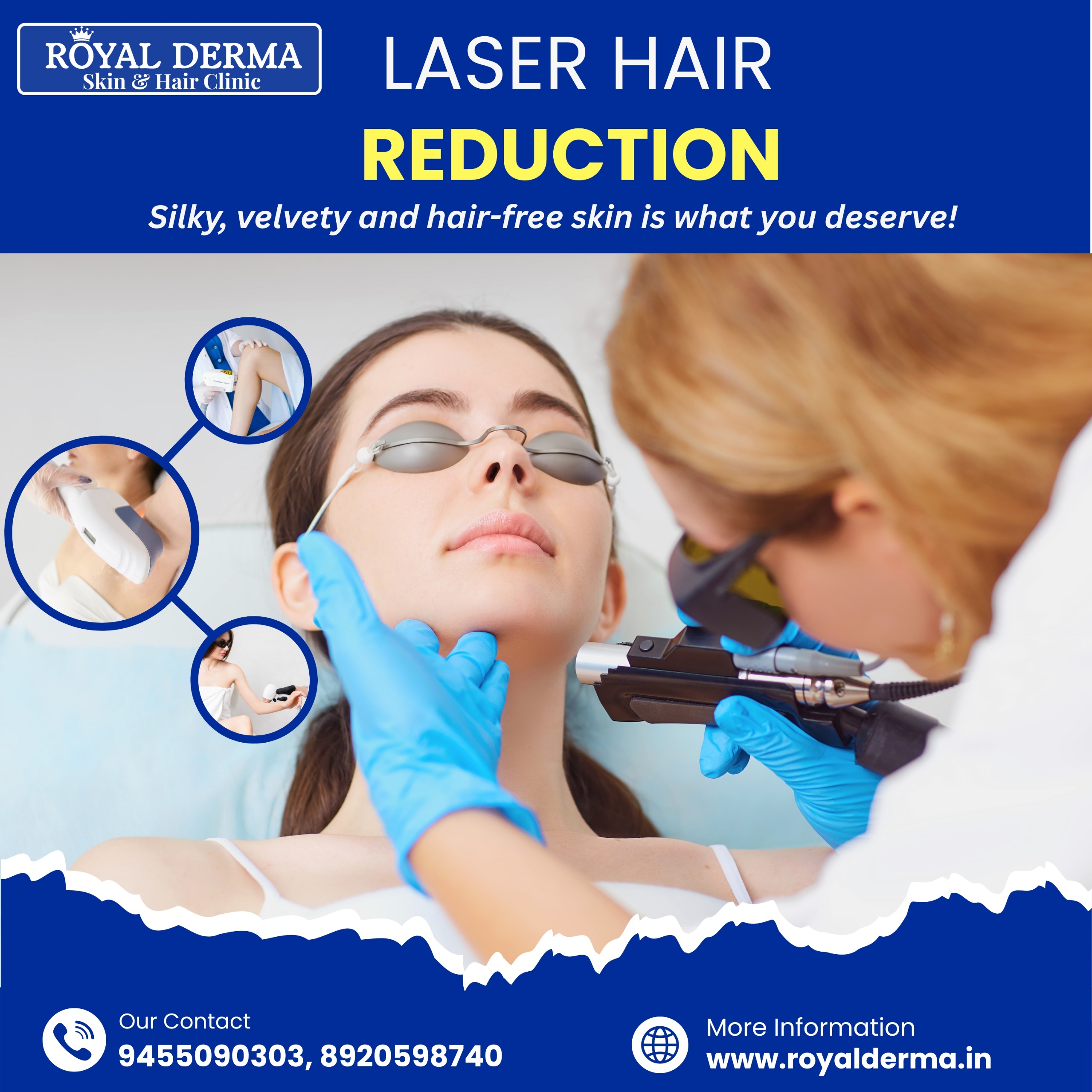 Laser Hair Reduction Treatment in Dwarka Affordable & Safe