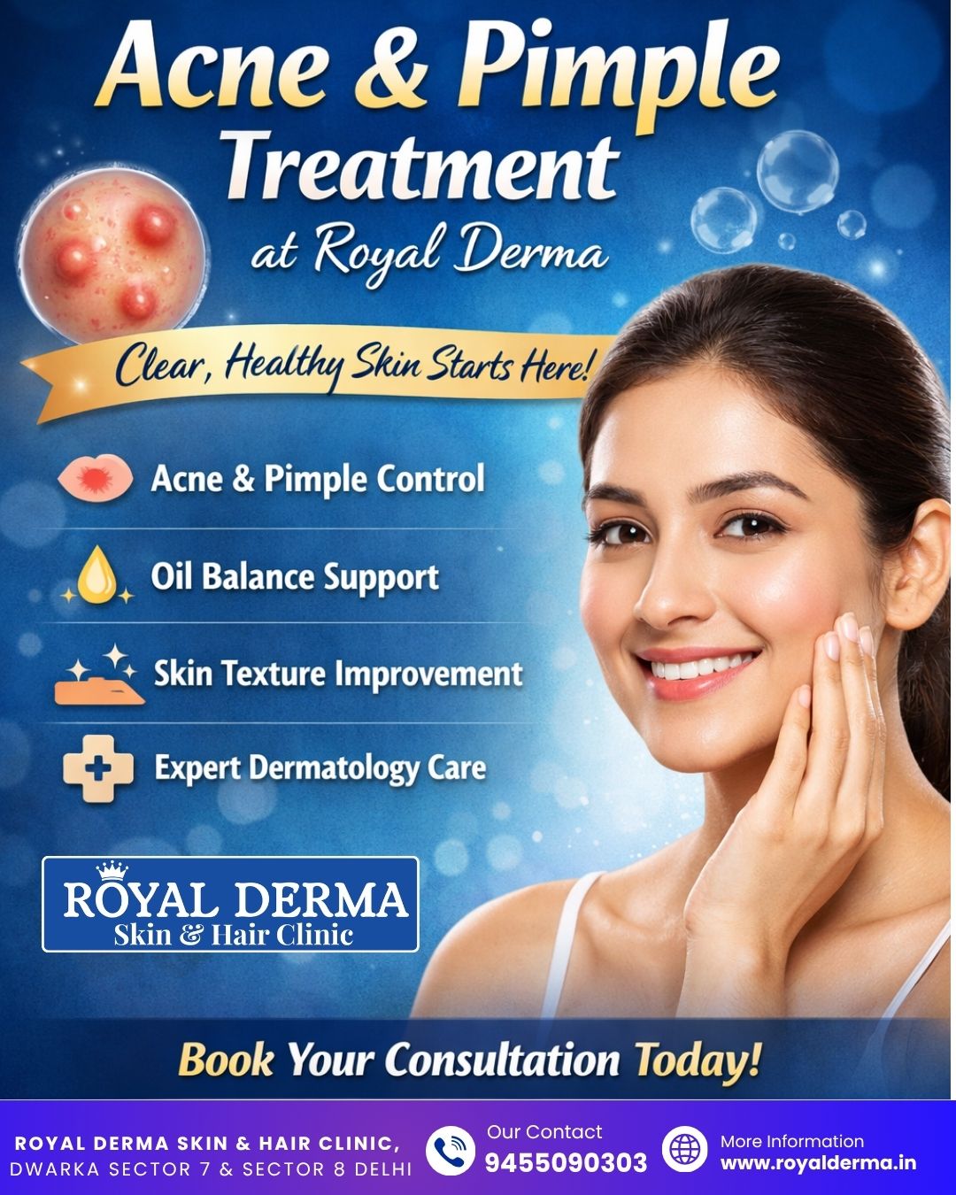 Acne & Pimple Treatment at Royal Derma