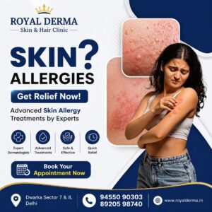 Skin Allergy Treatment in Dwarka Delhi Royal Derma Clinic