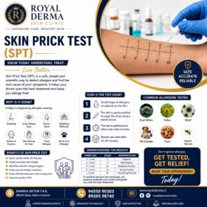 Allergy Problems Discover the Cause with a Skin Prick Test (SPT)
