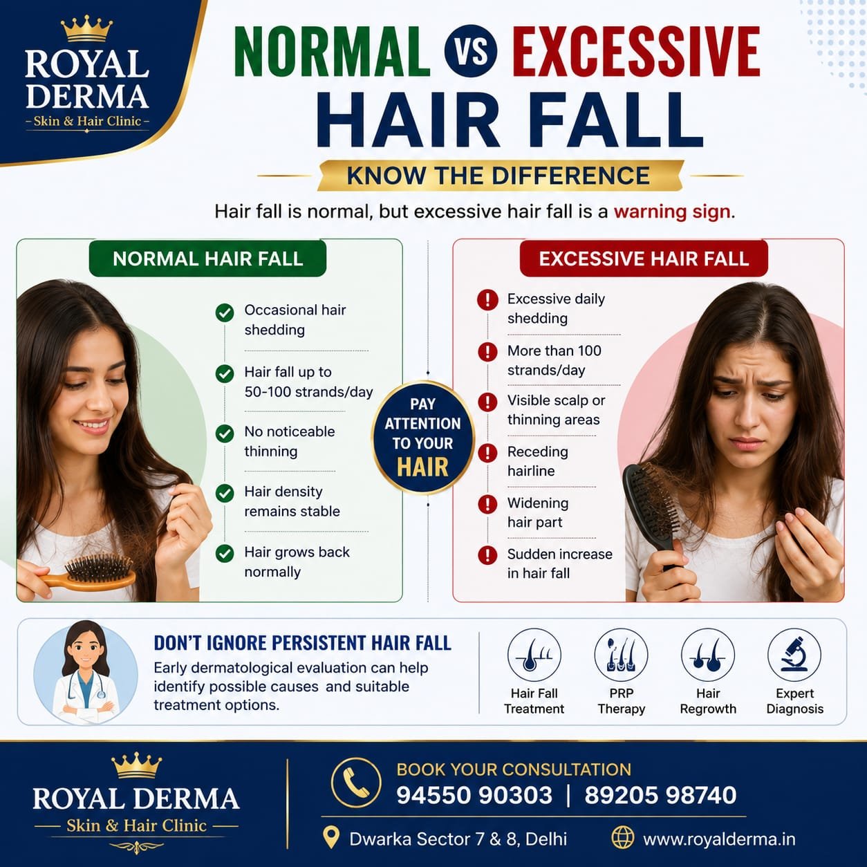 Hair Fall Treatment in Dwarka Delhi Royal Derma