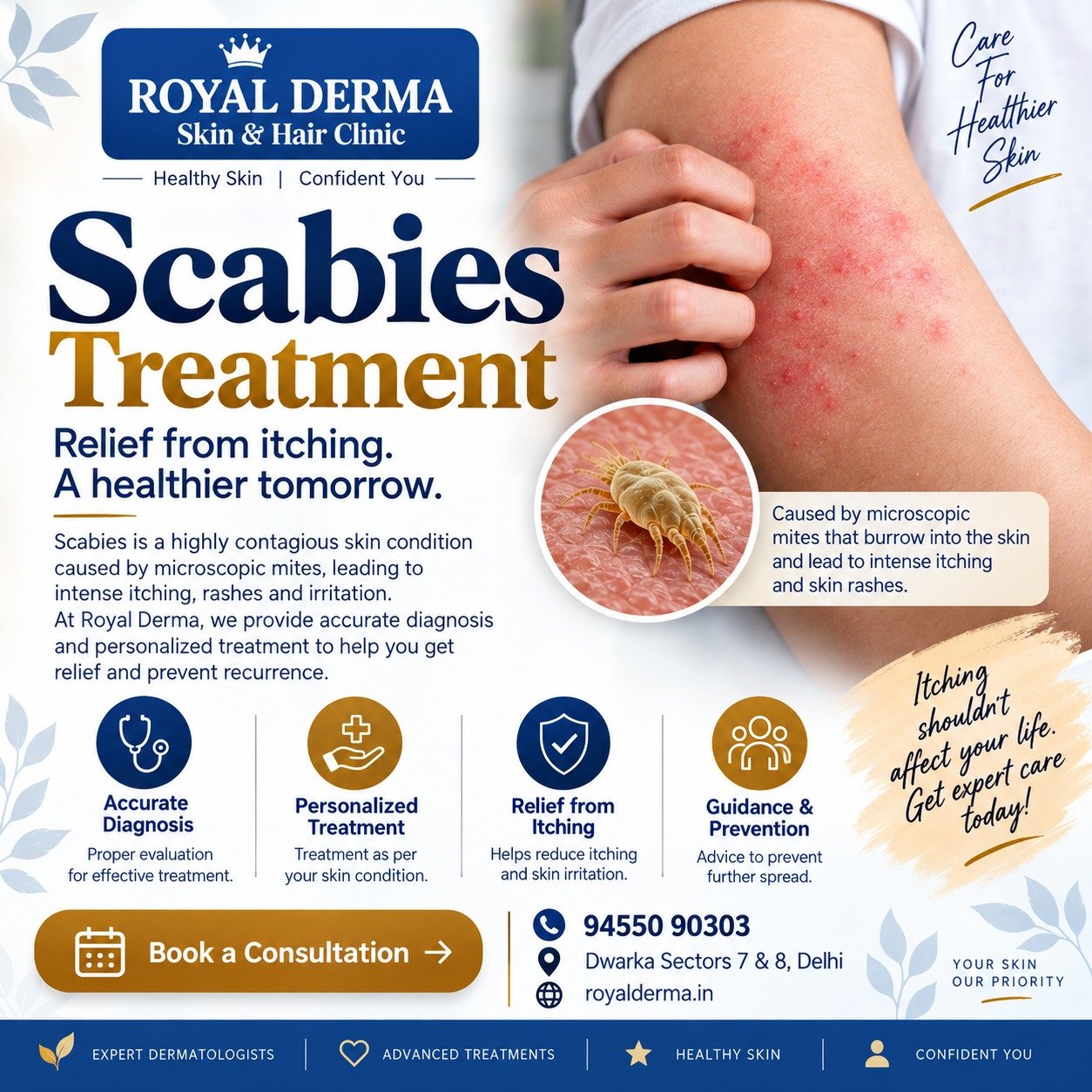 Scabies treatment in Dwarka delhi