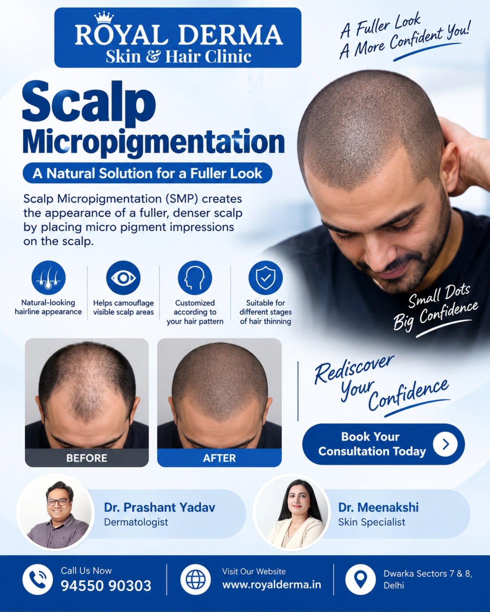 Scalp Micropigmentation in Dwarka Delhi